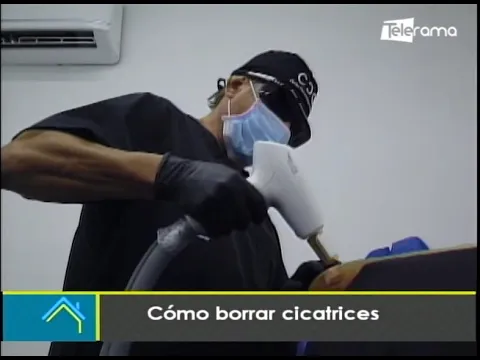 Cómo borrar cicatrices