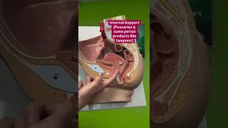 Some Vaginas Need Extra Support Pelvicfloorhealth Prolapse 