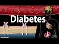 Diabetes mellitus - Symptoms Complication Pathology of Type 1 and Type 2 Animation