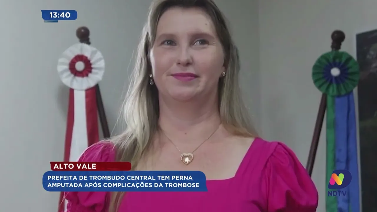 Prefeita de Trombudo Central tem perna amputada após complicações da trombose