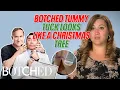 Crystal Wants to Fix Her Christmas Tree Tummy That Was BOTCHED in a Tummy Tuck Botched E