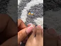 Yes The entire nail was hanging off