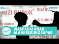 Download Lagu Waspadai sejak Dini Tanda Anak Alami Busung Lapar, Mulai dari Perut Buncit hingga Badan Kurus
