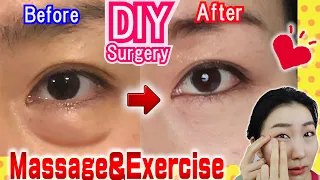 Download How to Remove Under Eye Bags👁️ Naturally in 7 Days Massage \u0026 Exercises🙋 MP3