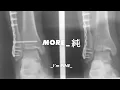 너 걸음걸이가 왜 그래