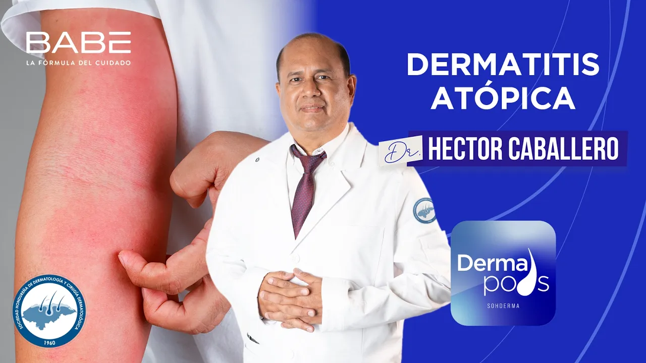 ✨ Dermatitis atópica ✨ | Dermapods | E8