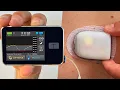 Download Lagu Omnipod 5 vs Tandem t:slim x2 | Full Test \u0026 Review
