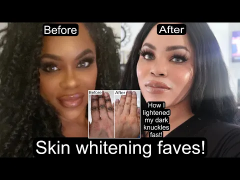 Download MP3 Skin Whitening Regimen How I lightened My Dark Knuckles Fast!!!