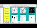 Malaria Detection From Blood Images Using Image Processing IEEE Based Projects