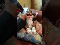 Download Lagu Micro Preemie Nova the Astronaut acting up in the NICU 8 1/2 weeks old
