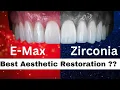 Best Material for Front Teeth Crowns Emax vs Zirconia Durability Aesthetics Strength
