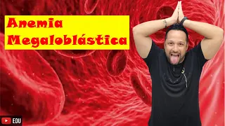 Anemia Megaloblástica - Tipos de Anemia - Sangue - Fisiologia Humana