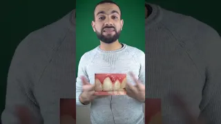 نزيف اللثه و التهاب اللثه الحاد وعلاجها 