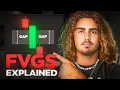 Download Lagu The Only Fair Value Gap Video You Need.
