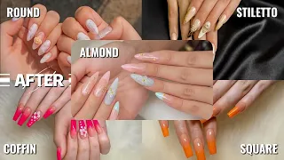 Gel X