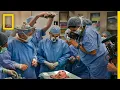 Youngest Face Transplant Recipient In U S National Geographic