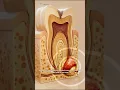 Tooth Abscess What is it