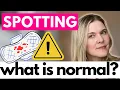 Is Spotting Normal When Should You Be Worried About Spotting Between Your Periods