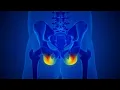 Human Skeleton and painful Hip Joint Pain stock footage stock Cinefootage