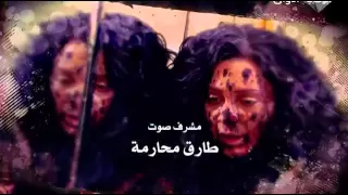 تتر الولادة من الخاصرة عالي الجودة 