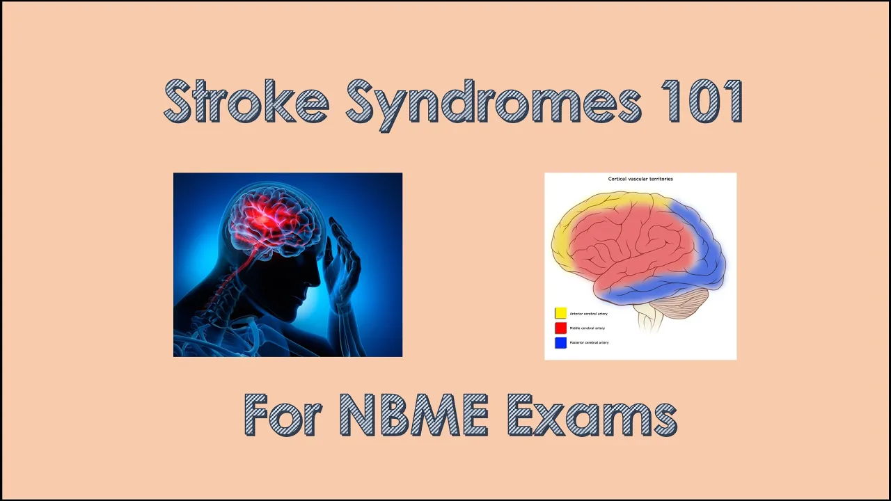 Stroke Syndrome Review 101 for NBME exams