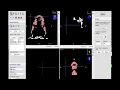 Segmentation by ITK Snap