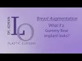 What if a Gummy Bear implant leaks