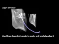 Open Inventor Toolkit Nerve Selection 3D Visualization Toolkit
