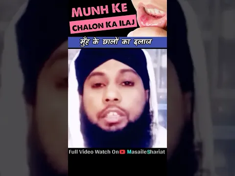 Munh Ke Chhalo Ka Ilaj by Sikander Warsi | #islamic_masail #learn_islam
