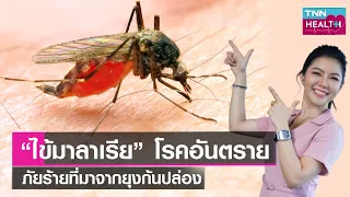 วิธีตรวจวินิจฉัยและรักษาไข้มาลาเรียทำอย่างไร