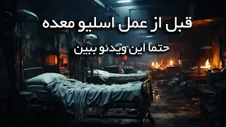 همه آن چیزی که باید درمورد عمل اسلیو معده بدانید 