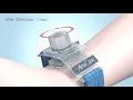 Download Lagu Anscare ChitoClot Artery Compression Device (Radial)