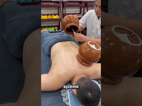Он уснул во время сеанса баночного массажа!
