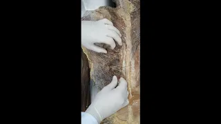VÍDEO AULA PRÁTICA DE MÚSCULOS DE DORSO