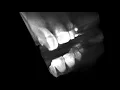 DICOM Visualization in VR