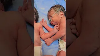 التوأم المتماثل                                          اكسبلور دندنها