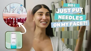 MARLYN - My Honest Reaction to Dermal Micro Points
