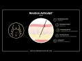 Revision AirSculpt