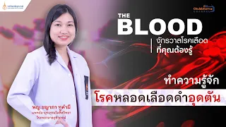 โรคหลอดเลือดดำอุดตันเกิดจากสาเหตุอะไรบ้าง