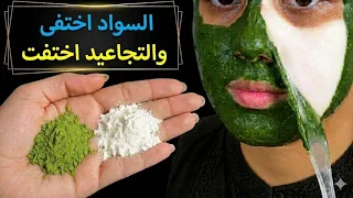 "ضعيه مرة واحدة فقط وسيختفي كل السواد والتجاعيد تماماً من الجذور! تفتيح فوري✨"