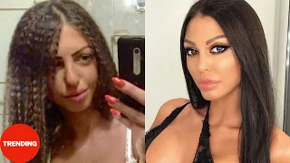 zadrugarke pre i posle plasti nih operacija