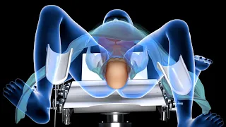 شاهد عملية الولادة الطبيعية كاملة Normal Vaginal Childbirth 3D Animation 