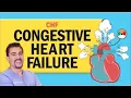Congestive Heart Failure CHF for Nursing NCLEX