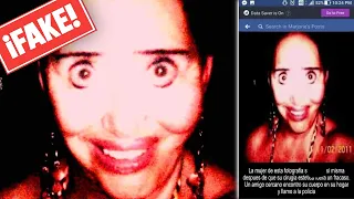 La Cirugía Estética Que Salió Mal |  Desmintiendo Imágenes Con Historias De Terror #31