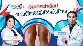 เริ่มจากเข่าเสื่อม กลายเป็นเข่าโก่งได้อย่างไรนะ 04/09/69 ลัดคิวหมอ | by RAMA Channel