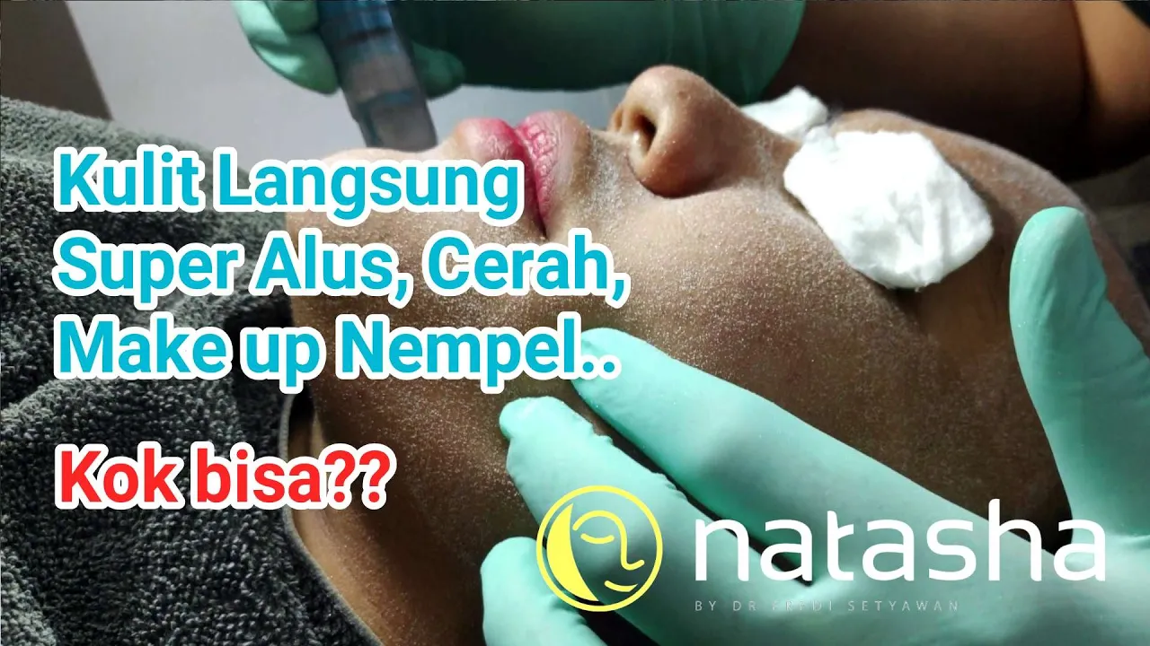 Cara Menghilangkan Flek Melasma Dengan Aman dan Cepat. Flek / Noda / hiperpigmentasi melasma memang . 