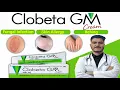 Clobeta GM Cream Use Composition How to Apply Side Effects and Price Clobeta GM Full Review