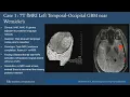 Clinical fMRI Case-based Learning and Strategies for Effective Program Design - Sample