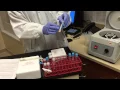 Platelet Poor Plasma for Protimes