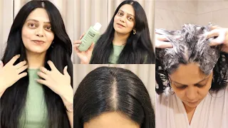 Dandruff mistakes to avoid & what actually worked for me